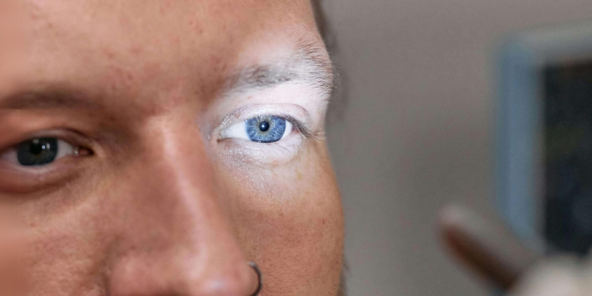 בדיקה רפואית כחלק מתהליך לקביעת פרופיל צבאי בצה"ל